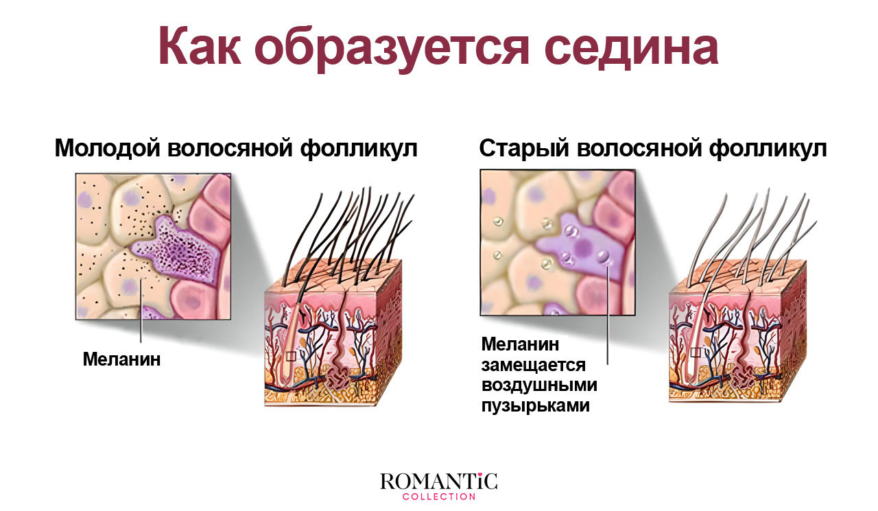 Можно ли предотвратить появление седины?